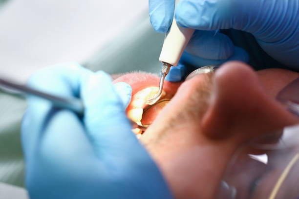 Best Emergency Gum Pain Relief  in Colfax, IL