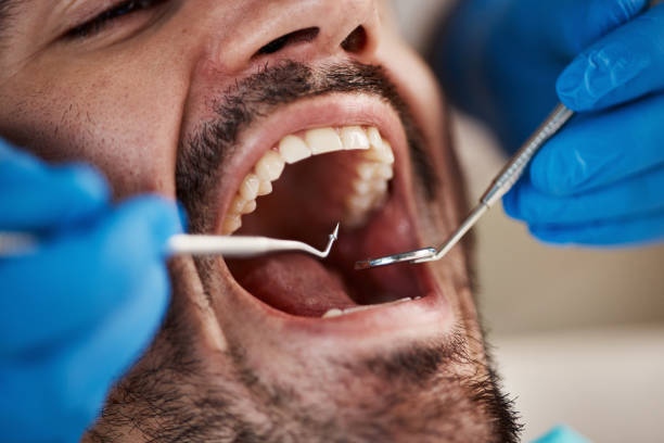 Best Urgent Tooth Repair  in Colfax, IL